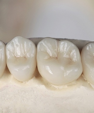 porcelain dental crowns