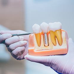 Dentist pointing to a dental implant model