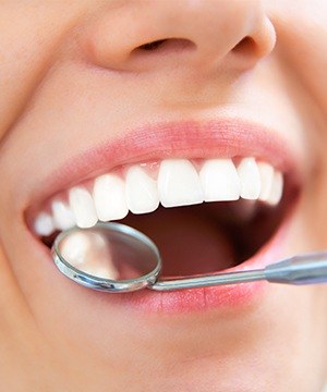 Closeup of patient during dental treatment