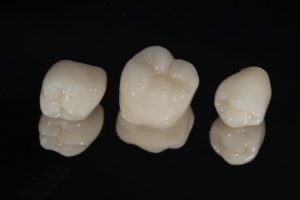 dental crowns