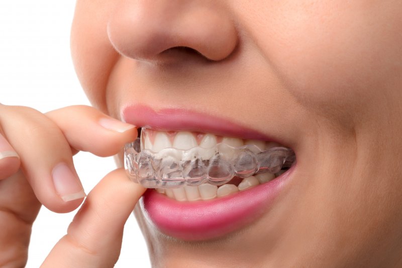 young woman wearing Invisalign