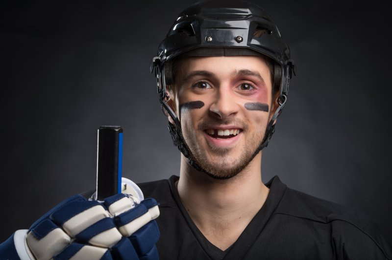 A hockey player with a missing tooth looking into the camera